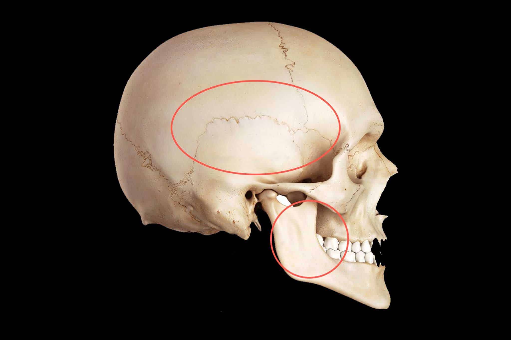 13-0-1-Kolbotn-Tannklinikk-TMD-Kjeveledd-Tyggemuskler-Skall-Tyggemuskler Slider som viser tyggemuskelområdet (i rødt) og kjeveledd/diskusområdet (lilla).